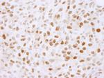 PLRG1 Antibody in Immunohistochemistry (Paraffin) (IHC (P))