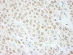 PLRG1 Antibody in Immunohistochemistry (Paraffin) (IHC (P))