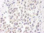 WRN Polyclonal Antibody