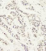 Artemis Polyclonal Antibody