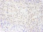 RPA70 Polyclonal Antibody