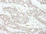 MAD2 Polyclonal Antibody