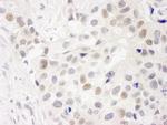 INT7 Polyclonal Antibody