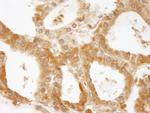 CC2D1A Antibody in Immunohistochemistry (Paraffin) (IHC (P))