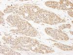 CC2D1A Antibody in Immunohistochemistry (Paraffin) (IHC (P))