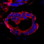 CC2D1A Polyclonal Antibody