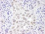 EMSY Antibody in Immunohistochemistry (Paraffin) (IHC (P))