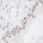 EMSY Polyclonal Antibody