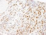 RPA32 Antibody in Immunohistochemistry (Paraffin) (IHC (P))