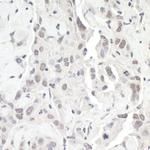 ZEB1 Polyclonal Antibody