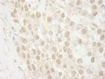 MTA3 Antibody in Immunohistochemistry (Paraffin) (IHC (P))