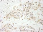 MTA3 Polyclonal Antibody