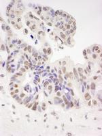 Tat-SF1 Polyclonal Antibody