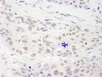 RAP1 Polyclonal Antibody