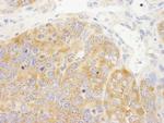 DDX6 Polyclonal Antibody