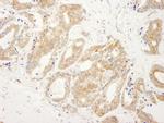 DDX6 Antibody in Immunohistochemistry (Paraffin) (IHC (P))