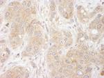 SNX1 Antibody in Immunohistochemistry (Paraffin) (IHC (P))