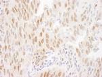 FOXO3a Antibody in Immunohistochemistry (Paraffin) (IHC (P))