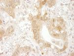 Paxillin Antibody in Immunohistochemistry (Paraffin) (IHC (P))