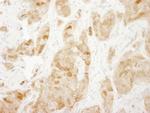 RPS6 Antibody in Immunohistochemistry (Paraffin) (IHC (P))
