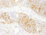 RPS6 Antibody in Immunohistochemistry (Paraffin) (IHC (P))