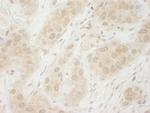 SYK Antibody in Immunohistochemistry (Paraffin) (IHC (P))