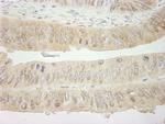 SYK Antibody in Immunohistochemistry (Paraffin) (IHC (P))
