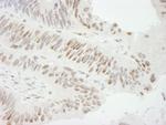 ZBTB7/FBI-1 Antibody in Immunohistochemistry (Paraffin) (IHC (P))
