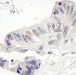 MAML1 Polyclonal Antibody