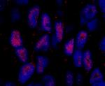 MAML2 Polyclonal Antibody