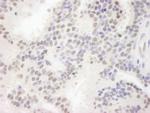 MAML3 Polyclonal Antibody