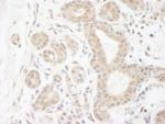 DDX20 Polyclonal Antibody