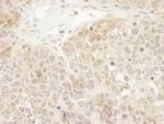 DJ-1 Antibody in Immunohistochemistry (Paraffin) (IHC (P))