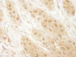 DJ-1 Antibody in Immunohistochemistry (Paraffin) (IHC (P))