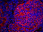 eIF2alpha/EIF2S1 Polyclonal Antibody