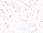 HIF1-alpha Antibody in Immunohistochemistry (Paraffin) (IHC (P))
