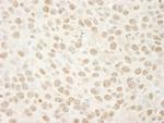 BRG1/SMARCA4 Antibody in Immunohistochemistry (Paraffin) (IHC (P))