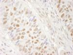 BRG1/SMARCA4 Polyclonal Antibody