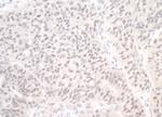 PIMT Polyclonal Antibody