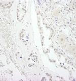USP34 Polyclonal Antibody