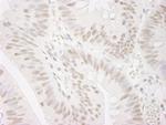 PPP4R3 Alpha Antibody in Immunohistochemistry (Paraffin) (IHC (P))