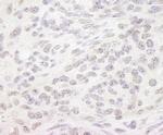 PPP4R3 Alpha Antibody in Immunohistochemistry (Paraffin) (IHC (P))