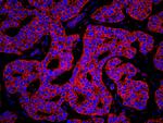 KARS Polyclonal Antibody