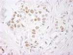 PPP4R3 Beta Antibody in Immunohistochemistry (Paraffin) (IHC (P))