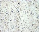 NCOA5/CIA Antibody in Immunohistochemistry (Paraffin) (IHC (P))