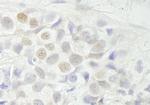 BCAS3 Polyclonal Antibody