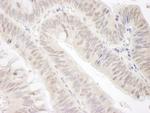 Gemin4 Antibody in Immunohistochemistry (Paraffin) (IHC (P))