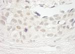 PPP1CB Polyclonal Antibody
