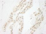 PPP1CC Polyclonal Antibody