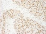 G9A/EHMT2 Polyclonal Antibody